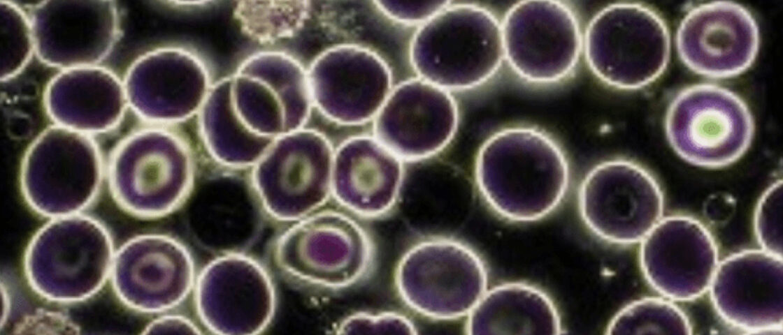 darkfield blood cell